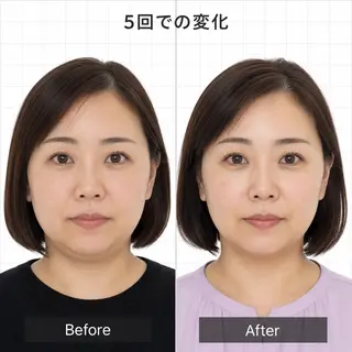 小顔・たるみ専門 DAZZLEのエステ・リラクイメージ