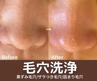 ラシュシュ 茨木のエステ・リラクイメージ