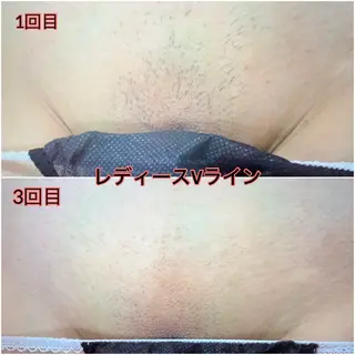 キッズ NR Nara yukiのエステ・リラクイメージ