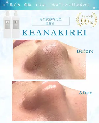 LiAm《美肌管理/ 小顔/脂肪ケア》のエステ・リラクイメージ