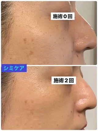プライベートサロン プリュネルのエステ・リラクイメージ