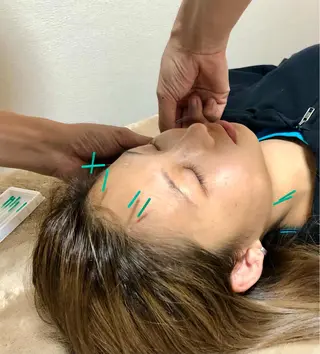 やはた 鍼灸整骨院のエステ・リラクイメージ