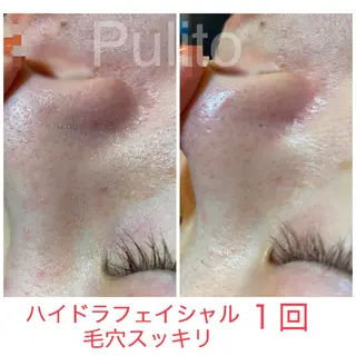 毛穴洗浄美肌プリート Pulitoのエステ・リラクイメージ