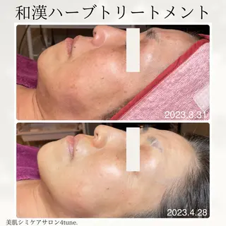 美肌シミケアサロン 4tune.RUMIのその他イメージ