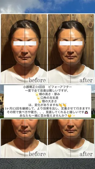 💎後悔させない小顔 矯正💎イトヤマ🌱のエステ・リラクイメージ