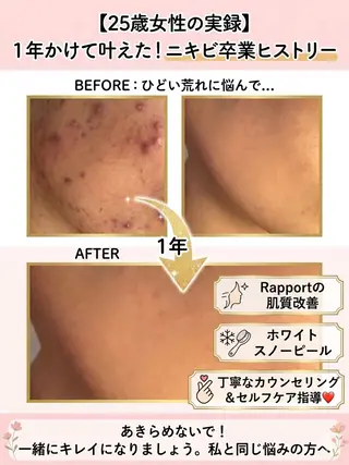 Rapport ラポールのエステ・リラクイメージ