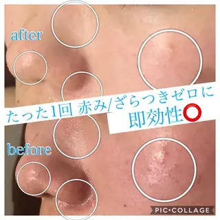 ロング カラー パーマ ヘアアレンジ キッズ ネイル マツエク・マツパ EnsorClair 代表 野口真央のエステ・リラクイメージ