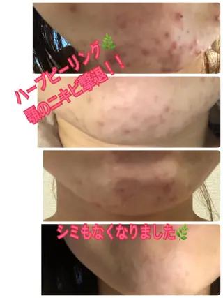 ❤️予約殺到❤️mi オールハンド痩身専門のエステ・リラクイメージ
