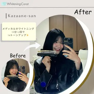 ホワイトニング カラット 恵比寿店のエステ・リラクイメージ