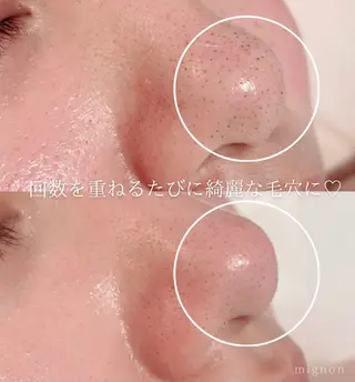 mignon 吉村のエステ・リラクイメージ