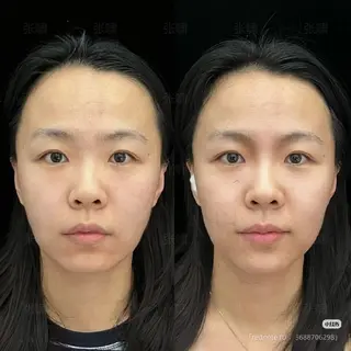 マツエク・マツパ 愛維美水光専門店 川崎彩鳳のエステ・リラクイメージ