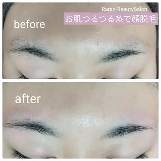 若返り 美肌   エステサロンららんのエステ・リラクイメージ