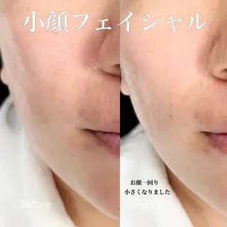 Balance facialのその他イメージ