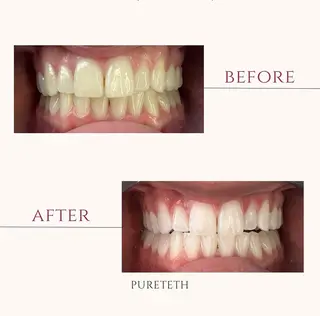 ホワイトニングサロン PURETETHのエステ・リラクイメージ