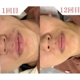 メンズ REONZ 取手店のエステ・リラクイメージ