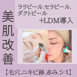 ニキビ/美肌 メゾンリュバンのエステ・リラクイメージ