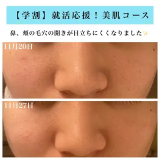 Bellesthe (ベルエステ)のエステ・リラクイメージ