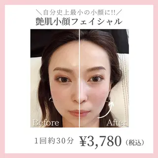 コガオファクトリー 北24条店のエステ・リラクイメージ