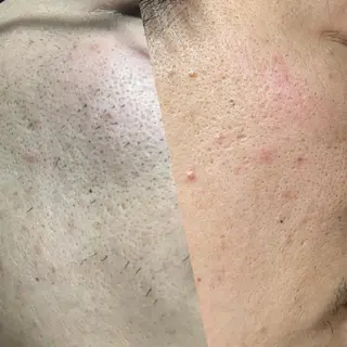 メンズ 脱毛サロン Plageプラージュのエステ・リラクイメージ