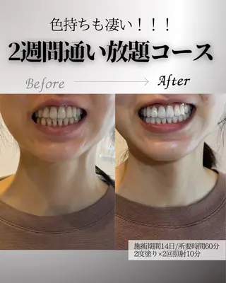 歯科提携エラン ホワイトニング一社店のその他イメージ