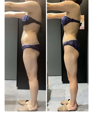 🤍Linola🤍 レイビス 須藤のエステ・リラクイメージ