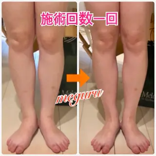 ショート カラー パーマ ヘアアレンジ メンズ キッズ ネイル マツエク・マツパ 痩身&ボディ 結果出し🌟丹野のエステ・リラクイメージ