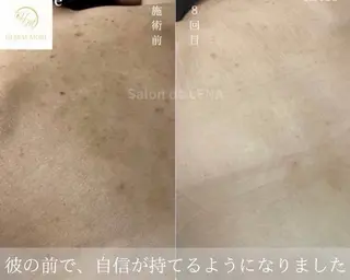ハーブピーリング専門 サロンドレナ平岡のエステ・リラクイメージ
