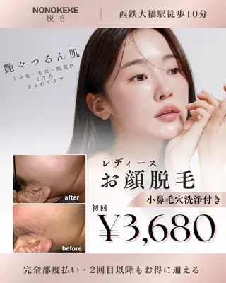 NONOKEKE ノノケケのエステ・リラクイメージ
