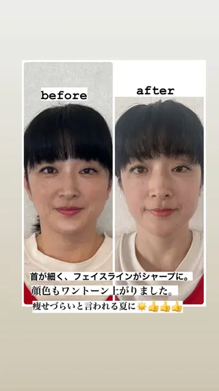 最先端温活・痩身 よもぎ・ハーブ蒸しのエステ・リラクイメージ
