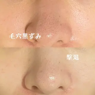 触れたくなる モテ肌へ...❤︎のエステ・リラクイメージ