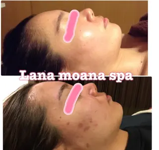 Lana moana spa🌺のエステ・リラクイメージ