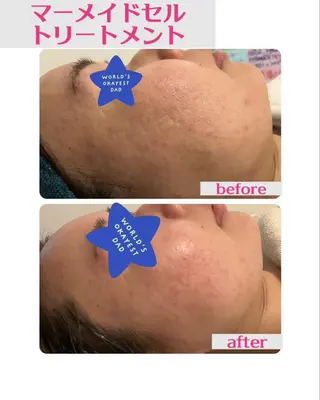 LUANA 美肌脱毛+Skinのエステ・リラクイメージ