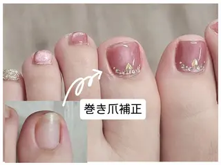ネイル ネイル&巻き爪サロン AKnailのネイルデザイン
