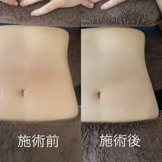 イナンナ⌇﻿腸もみ/ カッピング/痩身のエステ・リラクイメージ