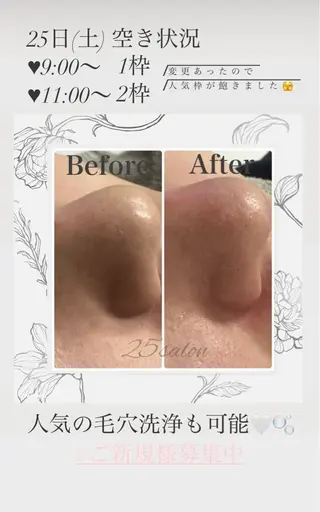 25salon MIHOのエステ・リラクイメージ