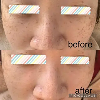 シミケア E Lashのエステ・リラクイメージ