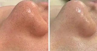 疲れ顔卒業✨肩こり 改善×小顔サロン 岡のエステ・リラクイメージ