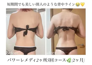 《本気痩せ×疲労改善 》  BILOOPのエステ・リラクイメージ