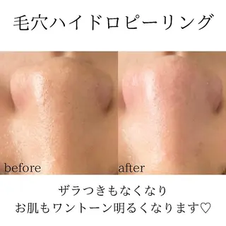 メンズ 稲嶺 美華のエステ・リラクイメージ