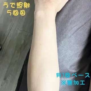 メンズ キッズ メンズ脱毛フェリッセ /男女🆗キッズ🆗のエステ・リラクイメージ