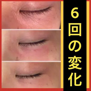 ショート カラー パーマ ヘアアレンジ メンズ キッズ ネイル マツエク・マツパ ニキビ・肌質改善専門 ♡人生が変わるサロンのエステ・リラクイメージ