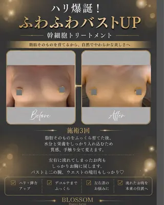 BLOSSOM 菊地幸子のエステ・リラクイメージ