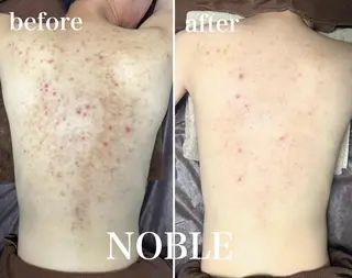 NOBLE 新宿南口店のエステ・リラクイメージ