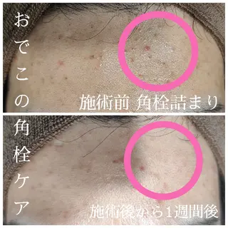 エステサロン LYSH愛名のエステ・リラクイメージ