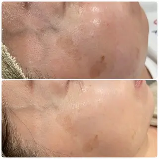 LiZA エステティックサロンのエステ・リラクイメージ