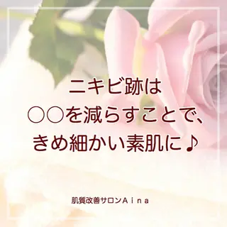 ミディアム パーマ ヘアアレンジ メンズ キッズ ネイル マツエク・マツパ ニキビ跡専門サロン Ainaのエステ・リラクイメージ