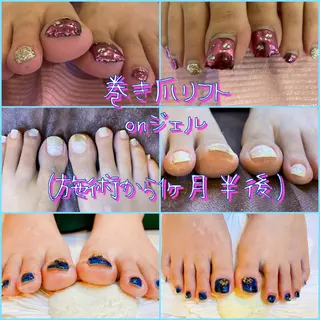 ネイル ♢ME2ROOM♢ #巻き爪#リラクのネイルデザイン