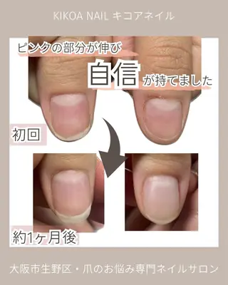 ネイル KIKOA NAIL キコアネイルのネイルデザイン