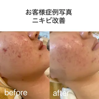 CPサロン ビバーチェのエステ・リラクイメージ