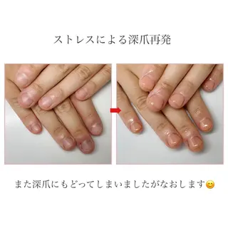 ネイル ネイルサロン アリュームのネイルデザイン